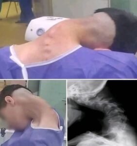 Read more about the article 7. Young Man Hospitalized Because He Dropped His Ca…See More