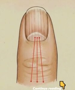 Read more about the article Nutrition for Stronger Nails: A Guide to Foods That Reduce Nail Ridges