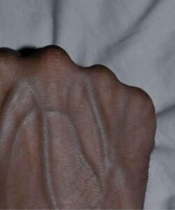 Read more about the article If your veins are visible, it means you are… See more