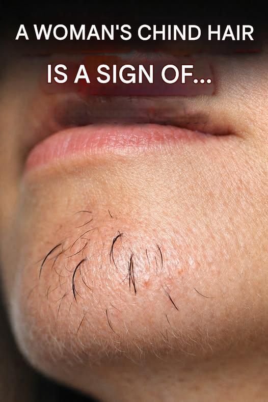 Read more about the article A woman’s chin hair is a sign