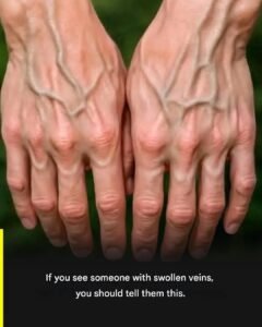 Read more about the article If your veins are visible, it means you are… See more
