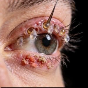 Read more about the article Here are the consequences of sleeping with a… See more