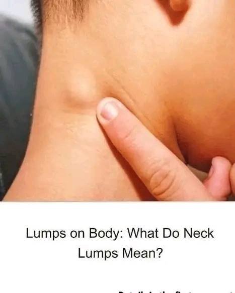 Read more about the article Lumps on Body: What Do Neck Lumps Mean?